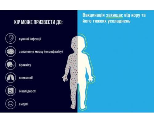 71,9% дітей до року в Україні вакциновані від кору